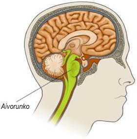 nukkuessa. Oireita on myös voimakas hampaiden narskuttelu päivän tai yön aikana. (Sanchez & Rocha 2011.) Kuva 1. Aivorungon sijainti ja poikkileikkaus.