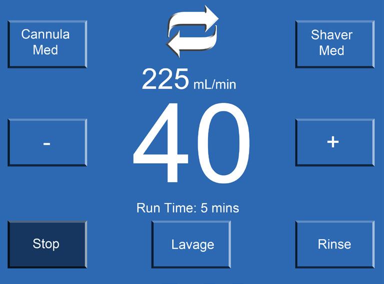 SISÄÄNVIRTAUS/ULOSVIRTAUS SISÄÄNVIRTAUS/ULOSVIRTAUS -KÄYTTÖLIITTYMÄ Cannula Suction Control (Kanyylin imun säätö) Aseta paine Paine alas Run/Stop (Käynnistä/pysäytä) Pysäytetty Käynnissä