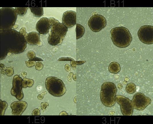 20 vaiheissa (1:1 DMEM/F12 + Glutamax/Neurobasal [Life Technologies] kasvatusliuos, 0,5x N2 [Life Technologies], 0,5x B27 [Life Technologies], 0,1 mm askorbiinihappo [Merck], 1x P-S).