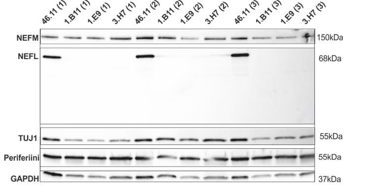 27 Kuva (10). Western blot NEFL-proteiinia ei havaita muokatuissa linjoissa. Kaivovalumaa on havaittavissa kaivoissa 1.B11 (2) ja 3.