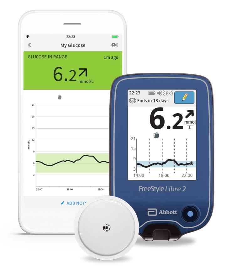 T1D HOIDON KEHITTYMINEN - SENSORIT Medtronicin Guard ja Dexcom vaatineet kalibroinnin ja sensorin käyttöaika lyhyt, vaihdot ja lataukset Libre vaatinut