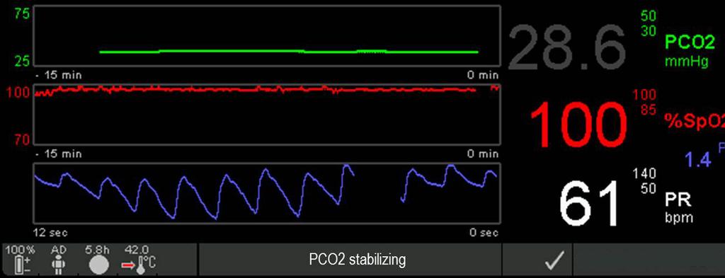 TC-parametrit ovat vakiintumassa tai PCO 2 stabiloituu tai PO 2 stabiloituu, jos vain toinen TC-parametri on vakiintumassa.