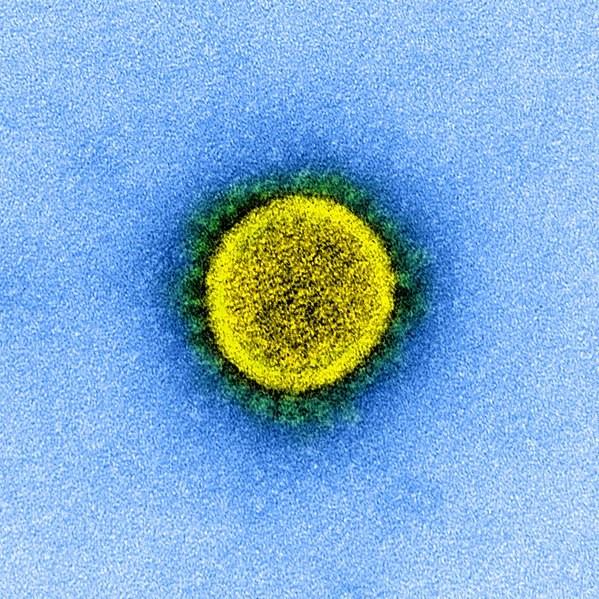 3 Kuvio 1. Koronavirus elektronimikroskoopissa (National Institute of Allergy and Infectious Diseases 2020.) Yleisimpiä oireita COVID-19 tartunnassa ovat kuume, kuiva yskä ja väsymys.