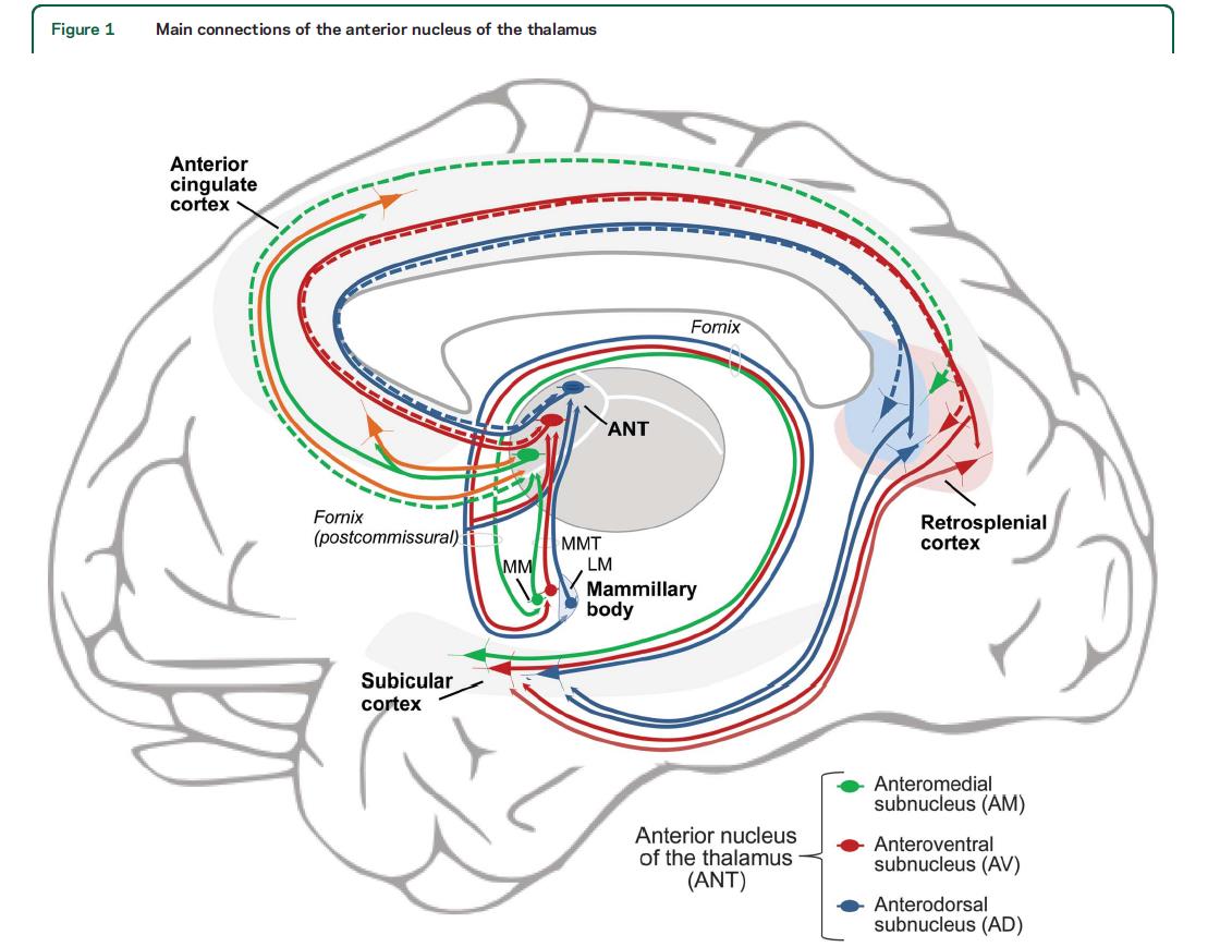 ESIMERKKI: EPILEPSIAN