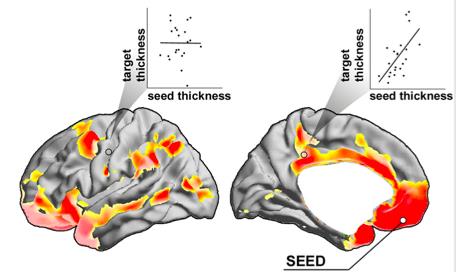 ERI AIVOALUEIDEN VÄLISTEN YHTEYKSIEN TUTKIMINEN: STRUCTURAL COVARIANCE