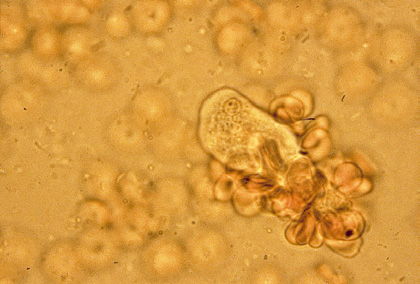 F) Cyclospora cayetanensis ulosteen Cryptosporidium-värjäyksessä.