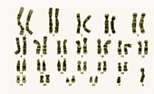 Kuva 6 Normaali naisen karyotyyppi eli kromosomisto. uusiin tekniikoihin kuuluu esimerkiksi Fluorescent In-Situ Hybridisaatio eli FISH-menetelmä.