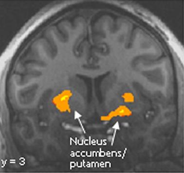 Similar to other drugs, alcohol can activate brain