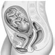 - Optimoidut protokollat - Rajoitettu kuvausalue - Säteilysuojaimet uvaus raskauden aikana