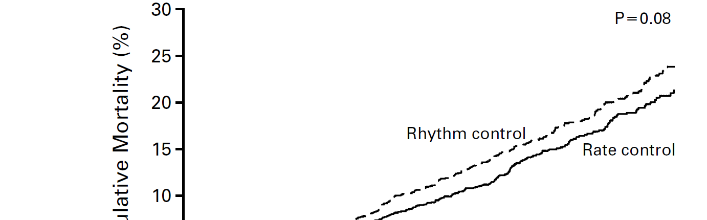 Rytminhallinta vai