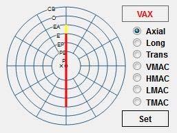 16.13 Koettimen asennon valinta Position map -toiminnon avulla on helppo taltioida koettimen asento yhdessä tallennetun B-Scan-kuvan tai -videon kanssa.
