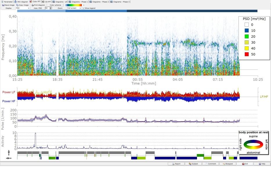 Sykevaihtelun säätäminen Data download or online emotion HRV sensor 24h HRV + body