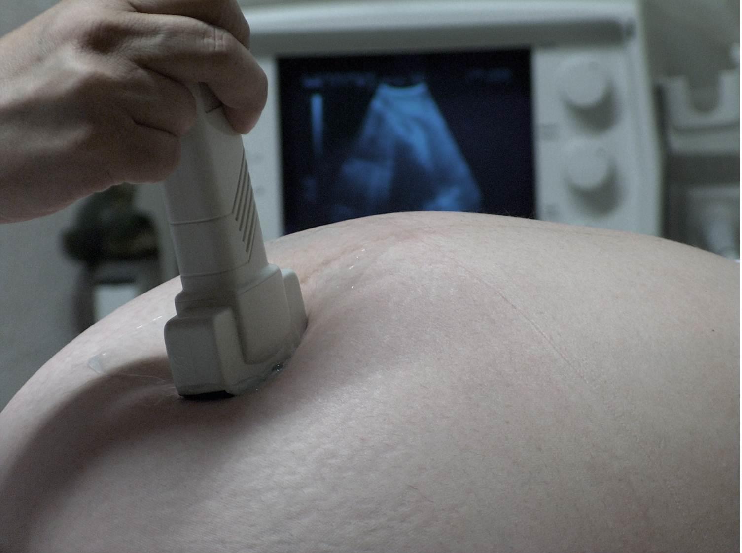 Fetal 4D-ultrasonography intervention for pregnant mothers and the