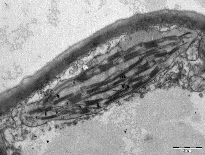 Tehtävä 1. a) Elektronimikroskooppikuva soluelimistä - Kuvassa on mitokondrio 1. Rakenteessa 1.