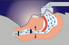 CPAP Continuous