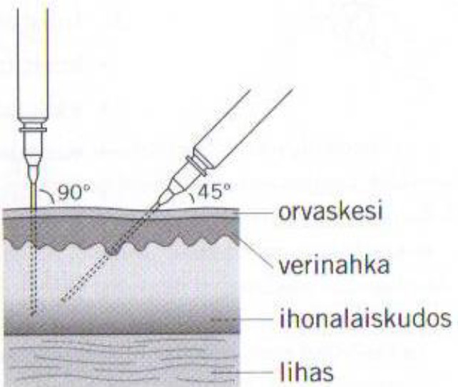 Uusimmat suositukset pistostekniikkaan löytyvät artikkelista New Injection Recommendations for Patients with Diabetes, kirjoittanut A. Frid et al. 2010, Diabetes & Metabolism 2010 Vol 36.