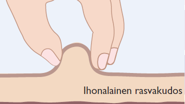 Pistostekniikka Yleiset ohjeet Oikea pistostekniikka on hyvän sokeritasapainon edellytys ja se tulisi tarkistaa säännöllisin väliajoin rasvakudoksen hyvän kunnon säilyttämiseksi.