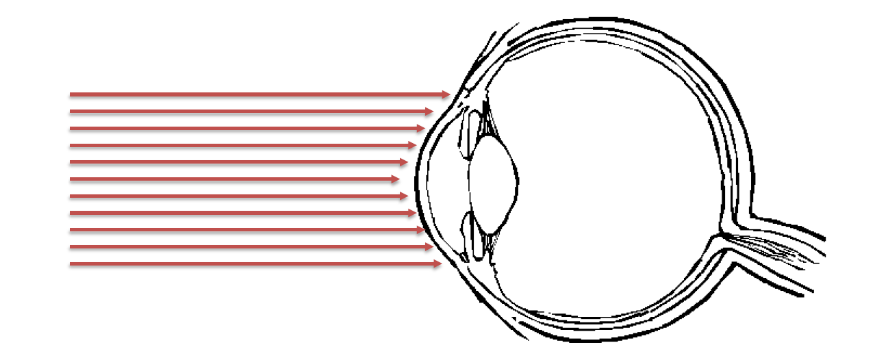 Suorat laser vaarat: Silmät IR-B ja IR-C >1400 nm