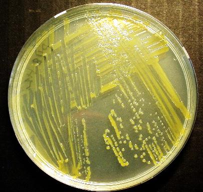 Flavobacterium psychrophilum Aiheuttaa kylmän veden tautia pääasiassa lohikaloille.