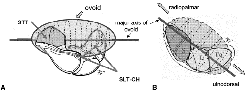 Keskirannenivelen luinen anatomia Hamatumin (ja lunatumin) luinen muoto