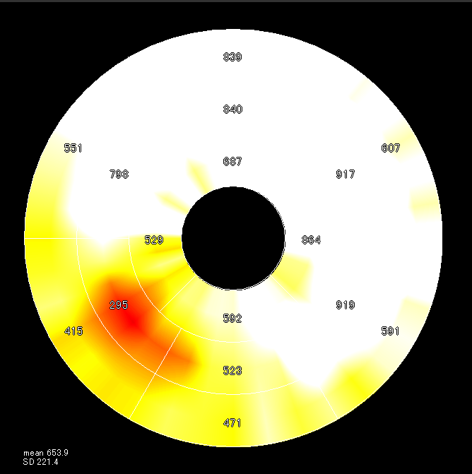 Radio-water PET Quantitative