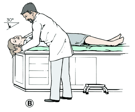 27 Dix-Hallpiken testissä (kuva 4, kohta A) tutkittava istuu hoitopöydällä siten, että selinmakuulle mennessä tutkittavan pää menee hoitopöydän yli.