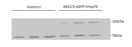 39 Kuva 15. AAV2/2-eGFP-hHsp70 transduktoitujen ARPE-19 solujen Western Blot- analyysi. ARPE-19 genomista peräisin olevat hhsp70 proteiinit näkyvät kuvassa molekyylipainonsa mukaisesti 70kDa kohdalla.