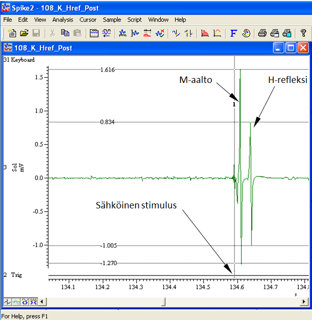 43 napaan. Stimuloinnissa käytettiin 0.2 ms:n kanttiaalto signaalia stimulaatiotaajuuden (manuaalinen) ollessa noin 0.2 0.3 Hz.