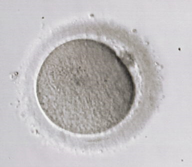 meioottinen jakautuminen pysähtyy profaasin diploteenissa jatkuu puberteetissa (jäljellä n. 40 000) n. 500 irtoaa ovulaatioissa, muut surkastuvat (atresia) primaariset oosyytit: meioosi I + 1.