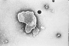 Respiratory syncytial virus (RSV) Paramyksoviridae (-) ssrna
