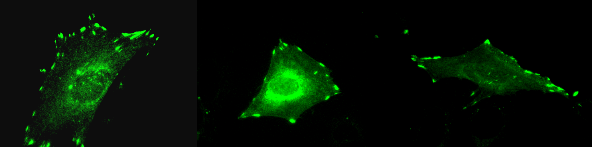 31 Kuva 13. αiib-gfp:n lokalisaatio tarttumisrakenteisiin SAOS-soluissa vitronektiinillä päällystetyillä peitinlaseilla 24 tunnin tarttumisen jälkeen. Kuvat Heikki Takala. Mittajana 10 μm. 6.