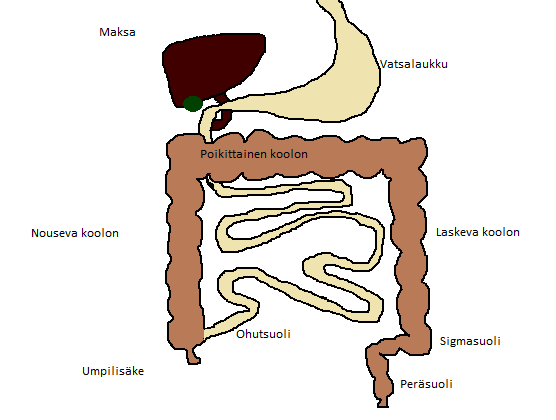 3 1 IBD Colitis ulcerosasta (haavainen paksusuolitulehdus) ja Crohnin taudista käytetään yhteisnimitystä IBD (Inflammatory Bowel Disease, suomeksi tulehdukselliset suolistosairaudet).