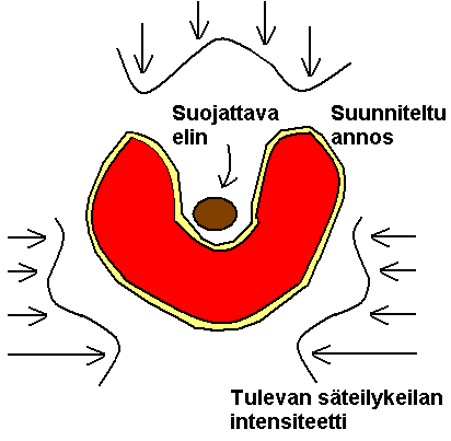 Kuva 5. Intensiteettimuokatun sädehoidon periaate. 3.