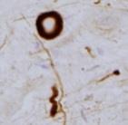 5 laskostuminen (Kuva 1).