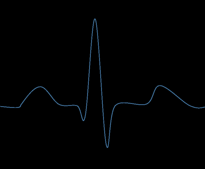 Kuva 2. EKG-signaali, jossa näkyvät P-aalto, QRS-kompleksi, T-aalto, P-Q-väli ja S-T-väli.
