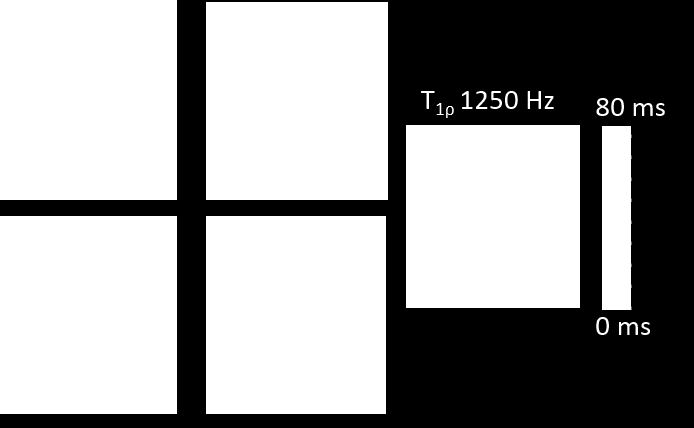 6.2 Relaksaatiomittausten tulokset T 1ρ -painotteisia magneettikuvia otettiin jatkuva-aaltoisella SL-RF-pulssilla, jonka teho oli 1250 Hz ja pituus vaihteli 0.4 ms ja 45.4 ms välillä.