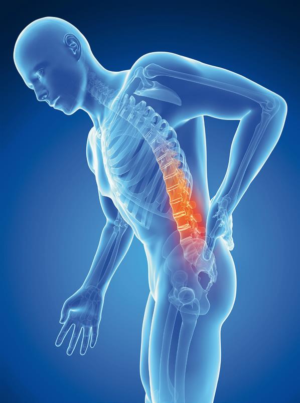 Selkärankareumapotilaan säännöllinen liikkuminen hoitaa sairauden aiheuttamia oireita tehokkaasti sekä estää selkärangan jäykistymistä.