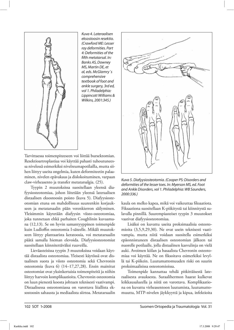 Resektioartroplastiaa voi käyttää pahasti tuhoutuneessa nivelessä esimerkiksi nivelreumapotilailla, mutta siihen liittyy useita ongelmia, kuten deformiteetin palaaminen, nivelen epävakaus ja