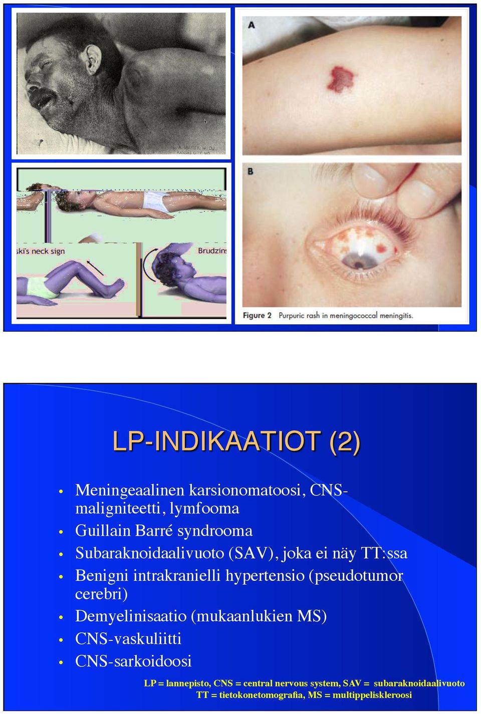 (pseudotumor cerebri) Demyelinisaatio (mukaanlukien MS) CNS-vaskuliitti CNS-sarkoidoosi LP =