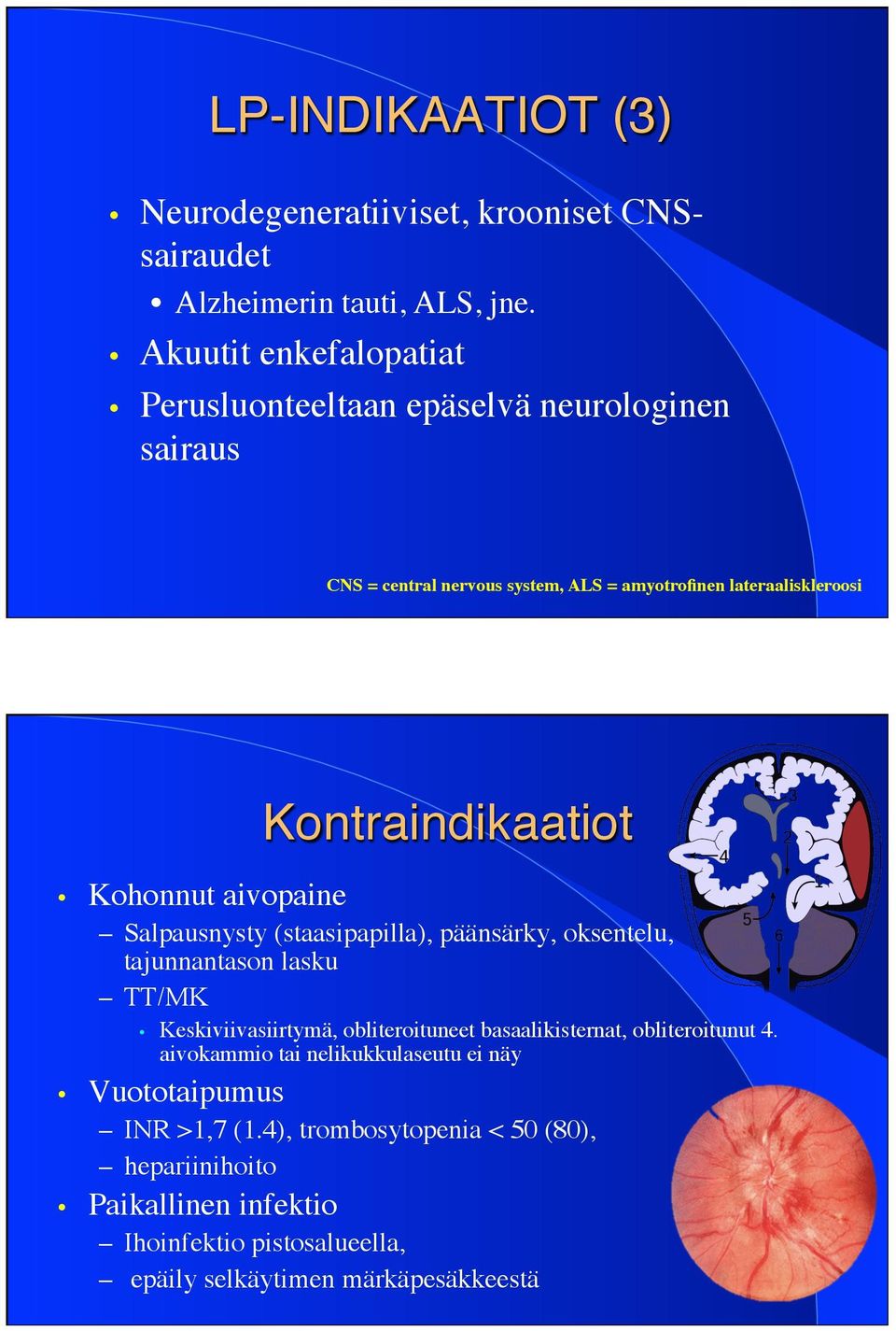 Kontraindikaatiot" Kohonnut aivopaine Salpausnysty (staasipapilla), päänsärky, oksentelu, tajunnantason lasku TT/MK Keskiviivasiirtymä, obliteroituneet