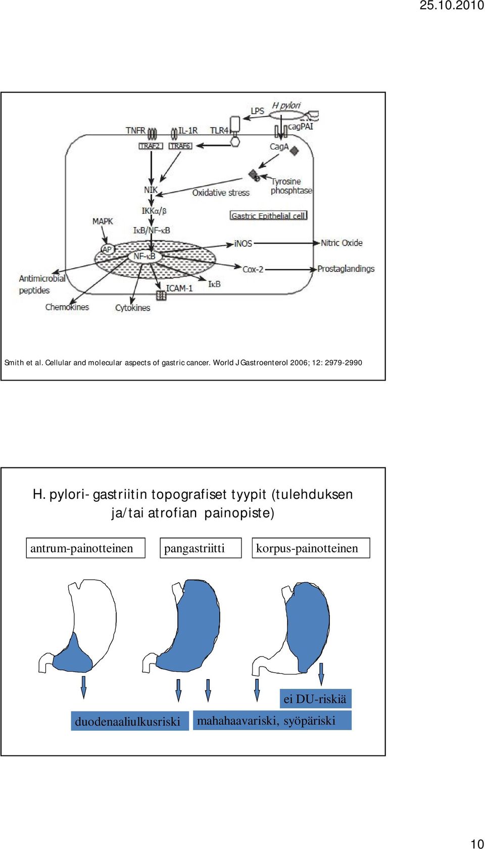 pylori- gastriitin topografiset tyypit (tulehduksen ja/tai atrofian