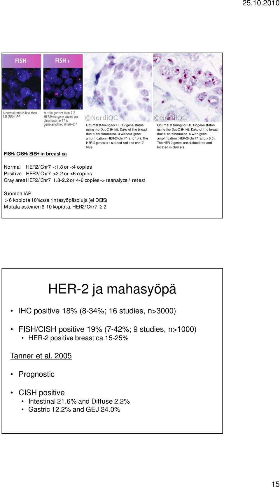 0). The HER-2 genes are stained red and located in clusters. Normal HER2/Chr7 <1.8 or <4 copies Positive HER2/Chr7 >2.2 or >6 copies Gray areaher2/chr7 1.8-2.