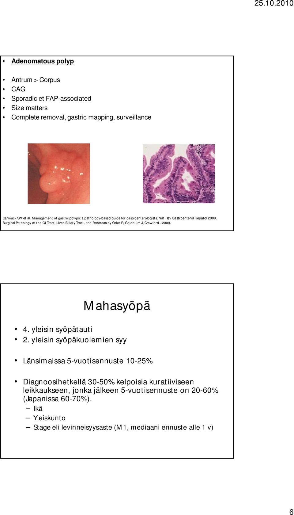 Surgical Pathology of the GI Tract, Liver, Biliary Tract, and Pancreas by Odze R, Goldblum J, Crawford J 2009. Mahasyöpä 4. yleisin syöpätauti 2.