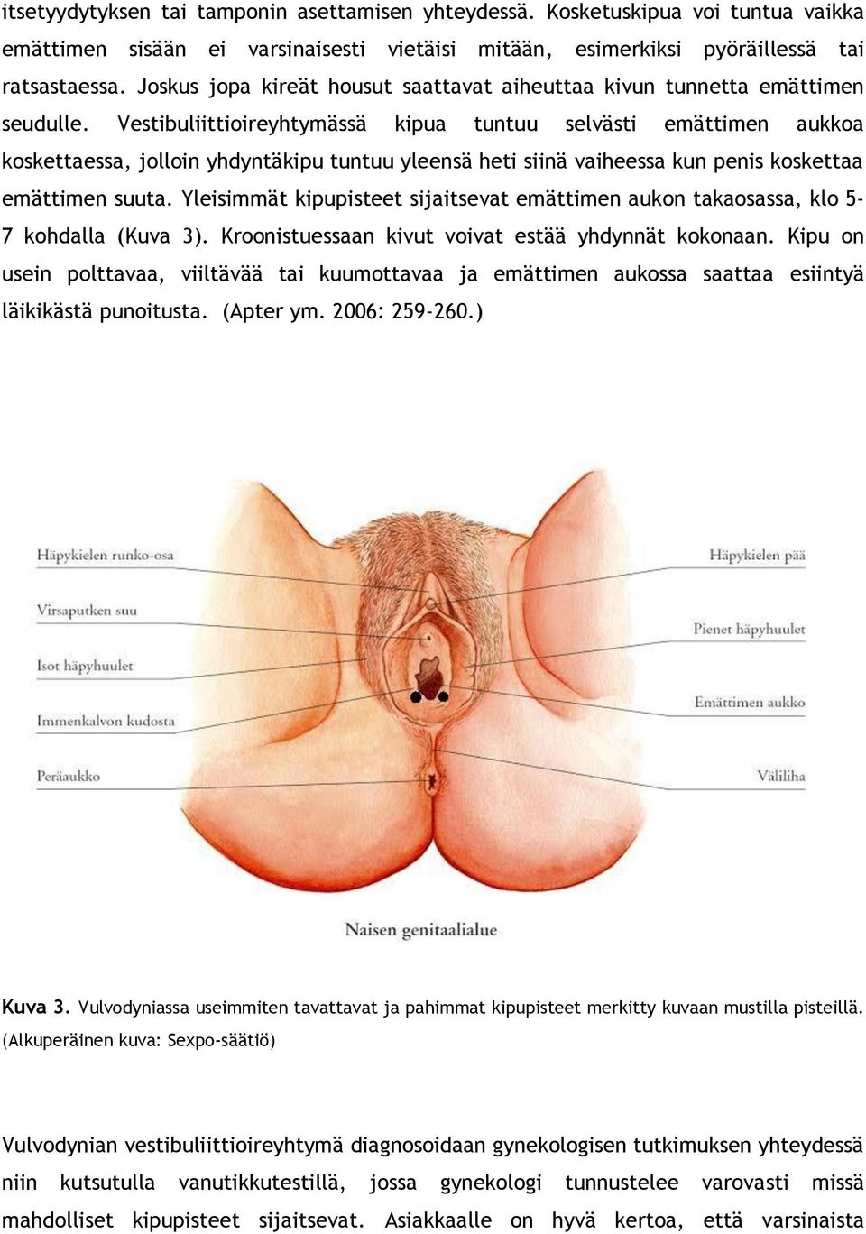 Vestibuliittioireyhtymässä kipua tuntuu selvästi emättimen aukkoa koskettaessa, jolloin yhdyntäkipu tuntuu yleensä heti siinä vaiheessa kun penis koskettaa emättimen suuta.