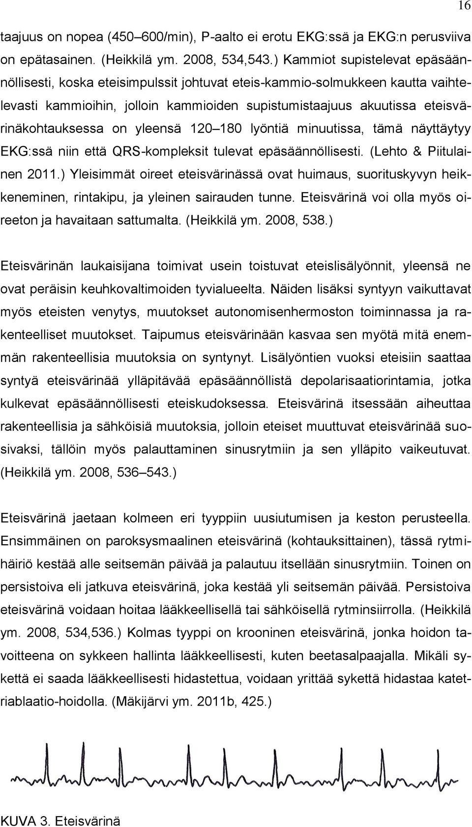 on yleensä 120 180 lyöntiä minuutissa, tämä näyttäytyy EKG:ssä niin että QRS-kompleksit tulevat epäsäännöllisesti. (Lehto & Piitulainen 2011.