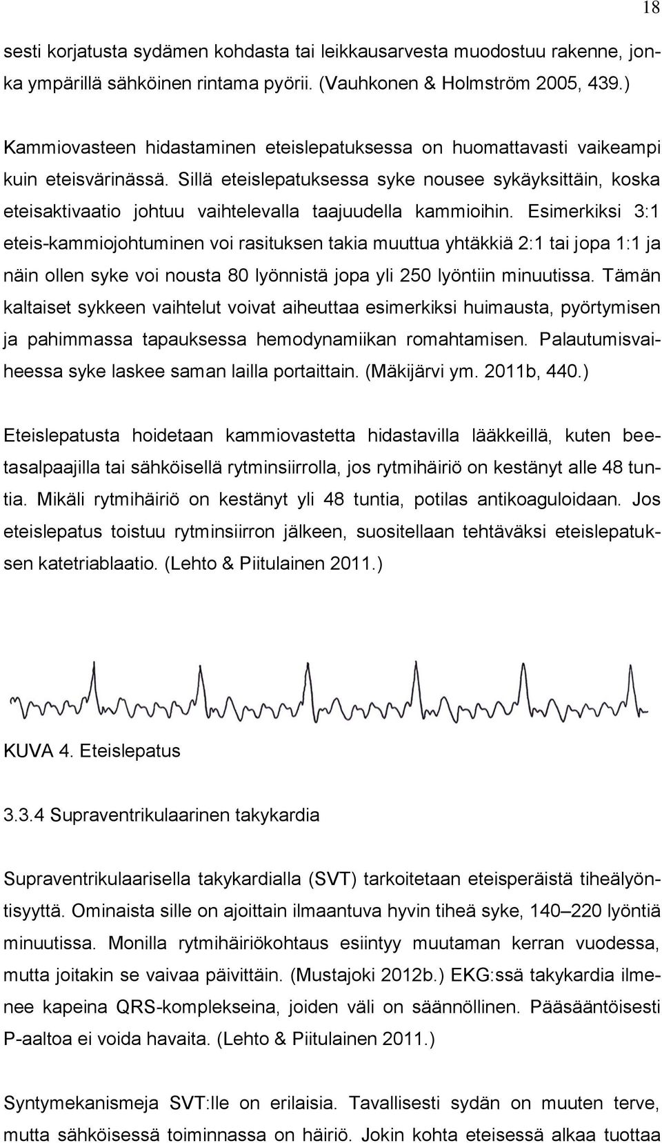 Sillä eteislepatuksessa syke nousee sykäyksittäin, koska eteisaktivaatio johtuu vaihtelevalla taajuudella kammioihin.