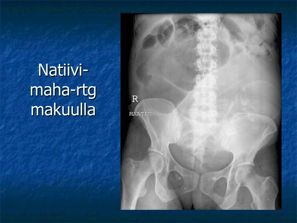 makuulla