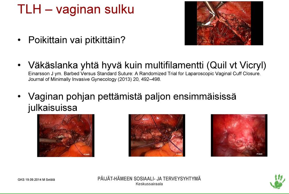 Barbed Versus Standard Suture: A Randomized Trial for Laparoscopic Vaginal Cuff