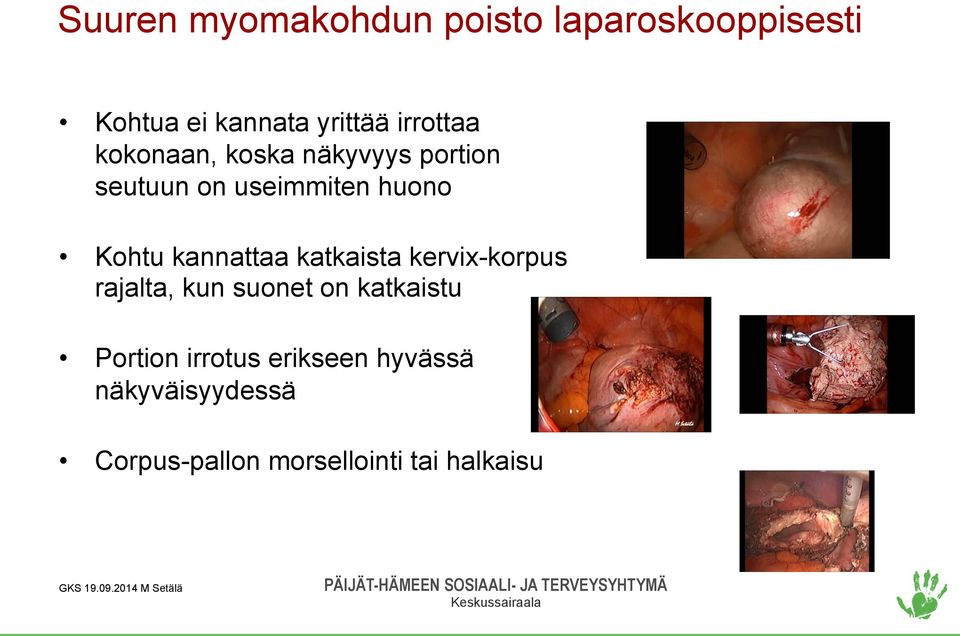 kannattaa katkaista kervix-korpus rajalta, kun suonet on katkaistu Portion