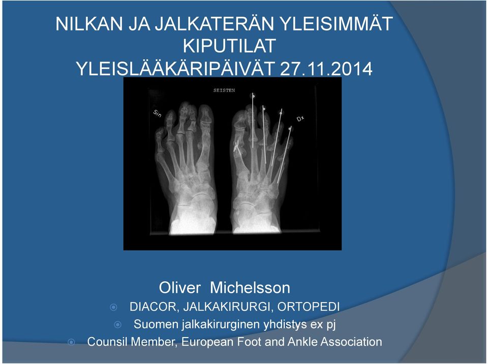 2014 Oliver Michelsson DIACOR, JALKAKIRURGI,